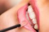 lèvre femme